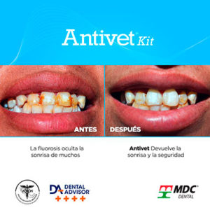 Productos de Blanqueamiento Dental - Deposito Dentalmex