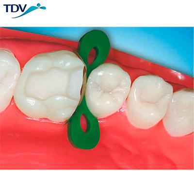 Cuñas Anatomicas de Madera TDV - Deposito Dentalmex